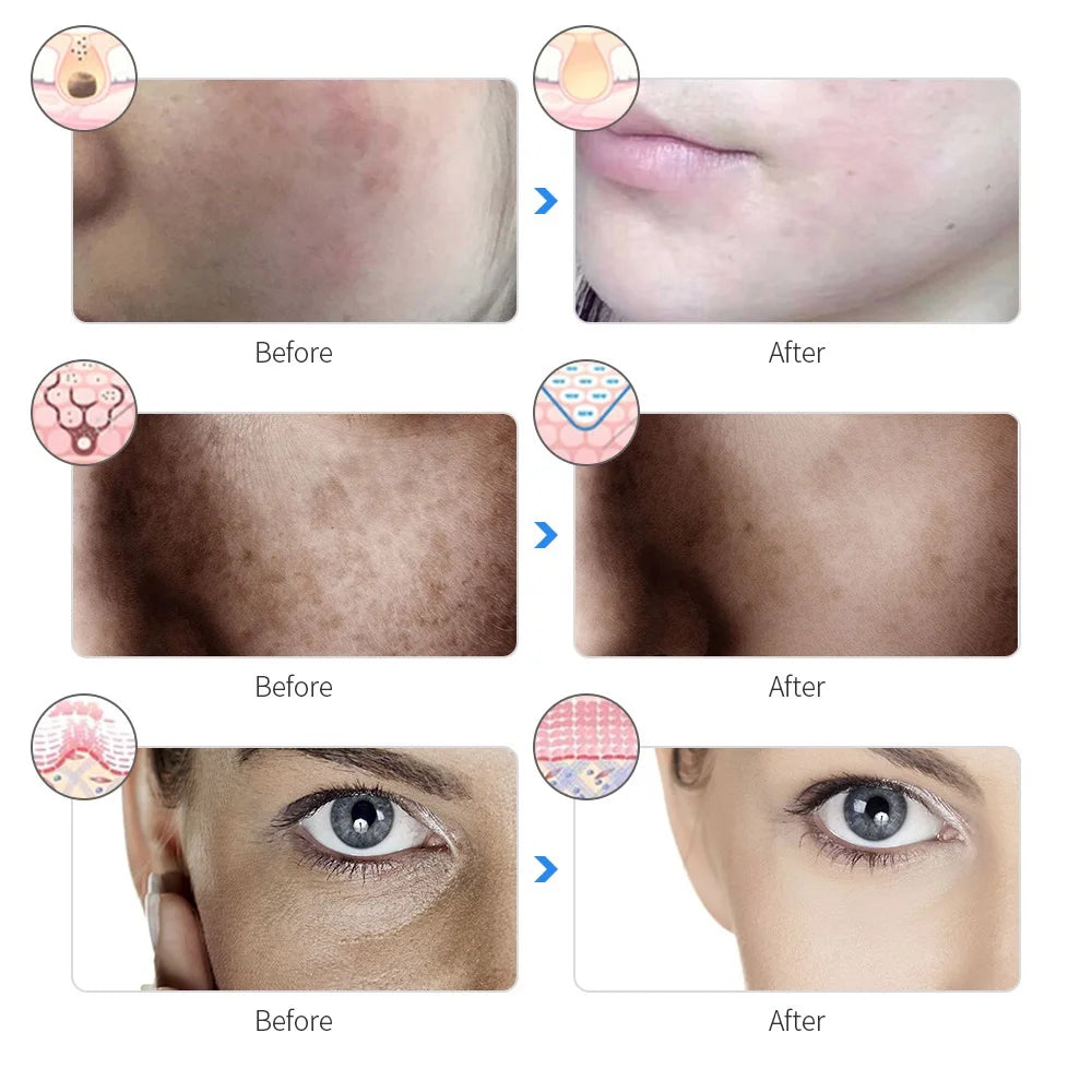 Radiance Rejuvenation Light Mask